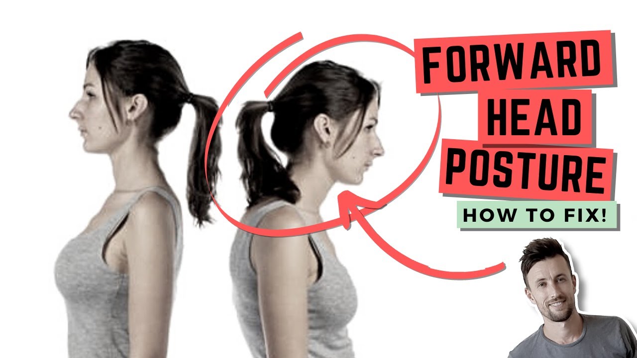 Effective Solutions for Correcting Forward Head Posture